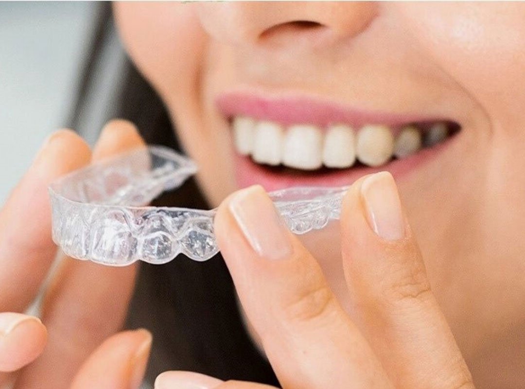 invisalign